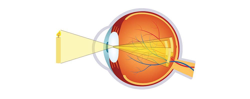 近視、遠視光線進入眼睛匯聚位置